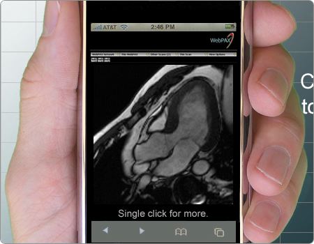 iPhone heart image